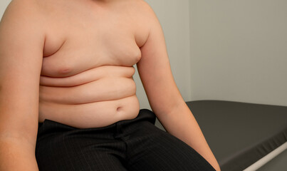 Fototapeta premium Folds on the belly of a fat boy. Obesity and excess weight concept. Tummy tuck, flabby skin on a fat belly, plastic surgery concept. Concept of excessive weight, obese, dieting and overweight