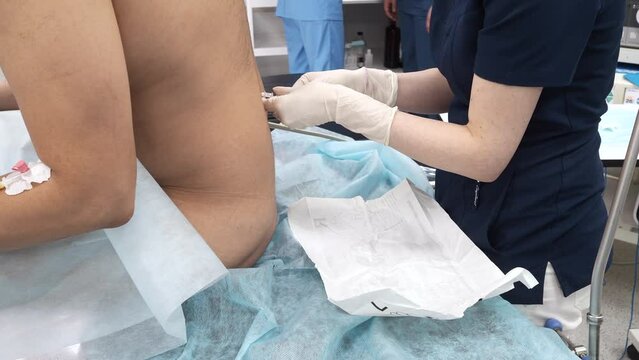 The anesthesiologist inserts an epidural needle into the patient's back. Spinal anesthesia injection. Injection of epidural anesthesia in preparation for surgery.