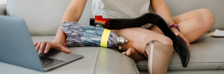 Smiling young white disabled woman with prostetic leg