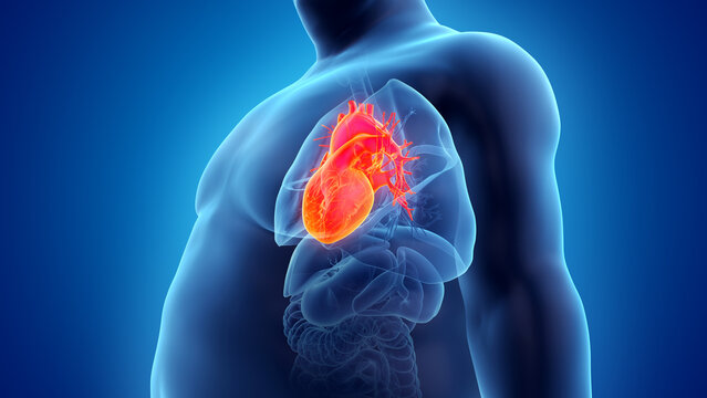 3d rendered illustration of an obese mans heart