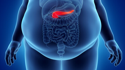 3d rendered illustration of an obese mans pancreas - obrazy, fototapety, plakaty
