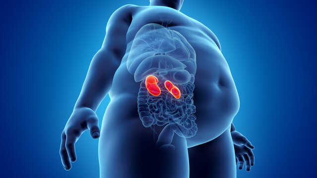 3d rendered illustration of an obese mans kidneys