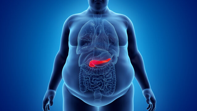 3d rendered illustration of an obese mans pancreas