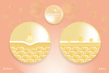 Hyaluronic acid before and after skin solutions ad, gold collagen serum drops with cosmetic advertising background ready to use, illustration vector.