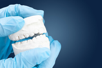 Orthodontist's hand, covered in a blue medical glove holding a dental mold of the lower jaw. The...