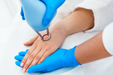Laser Skin Resurfacing. Doctor in blue glove holding patient hand. Laser therapy to use an equal method of rejuvenation