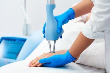 Laser Skin Resurfacing. Doctor in blue glove holding patient hand. Laser therapy to use an equal method of rejuvenation