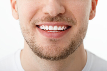 The smile of a young man in close-up. The result of teeth whitening. Beautiful smile with white healthy teeth.