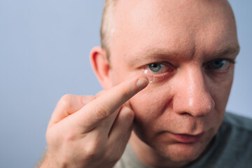 Man inserting clear transparent contact lens in eye. Correction of myopia eyesight