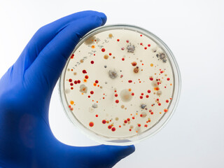 A hand in a blue glove holds a cup with different red colonies of bacteria. Study of bacteria in a...
