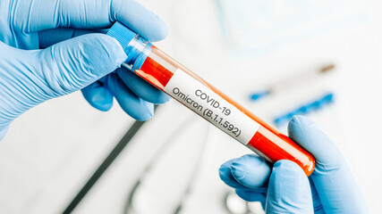 Omicron mutation coronavirus variant. Medical laboratory doctor holding test tube in hospital...