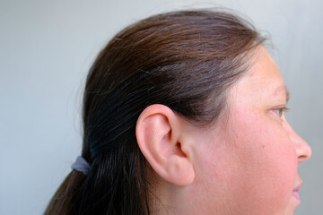 close-up of face of adult woman in profile, sore ear, concept of health care, hearing organs health, prevention of otitis media and hearing loss, World Hearing Day