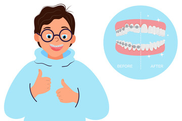 Happy child shows thumbs up. Smiling boy showing braces, isolated on white background. Under a magnifying glass, uneven teeth in the bracket system and straight after treatment. Vector illustration