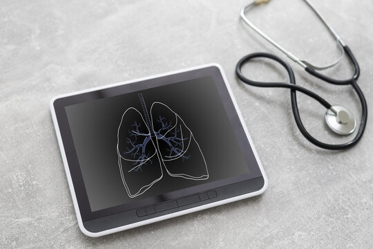 a picture of lungs on a tablet in a hospital. Horizontal composition.