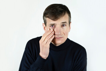 A middle-aged man suffers from eye fatigue from constant work at the computer, red eyes, possibly conjunctivitis. Red tired eyes in a man