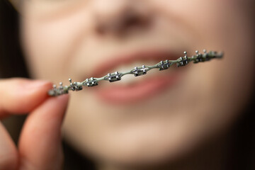 A woman is holding her braces and smiling after having her braces removed. 