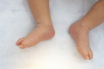The skin of a newborn's feet on a white cloth