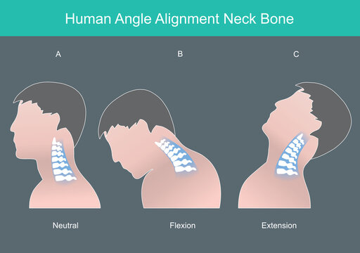 Human angle alignment neck bone. Human neck bone in correct angles. Illustration infographic..