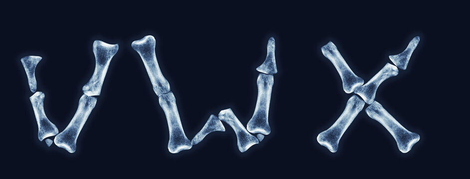 X-ray alphabet. Bone letters V, W, X. Realistic illustration. Black background.