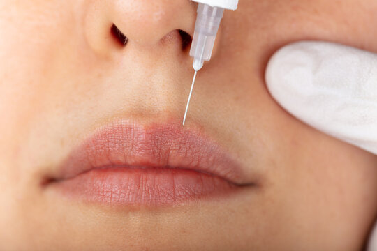 Young lady getting injections for bigger, fuller lips. The woman in the beauty salon. Plastic surgery clinic.
