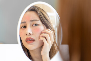 Beautiful Asian women are worried about faces allergic to chemicals in cosmetics. red face from...