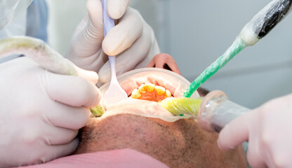 Dental clinic. Doctor dentist treats teeth to the patient in the dental clinic. Dentistry and orthodontist. Dental treatment and bite correction.