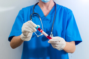 Scientist holding test tube with blood sample, focus on hand.