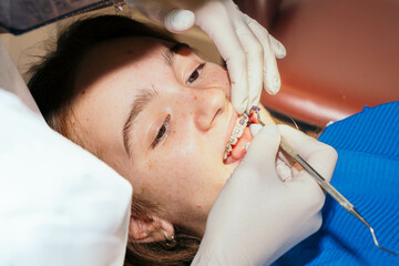 Dentist adding rubber bands to brackets on a red-haired girl.	