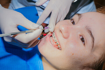 Teenage girl smiling as her orthodontist places colored rubber bands on her braces. 