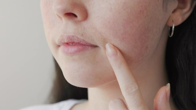 Close-up of a female's face with a mustache over her upper lip. The woman runs her finger over them, pointing to the flaw. The concept of depilation and removal of unwanted hair.