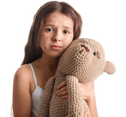 Little girl ill with chickenpox holding toy, isolated on white
