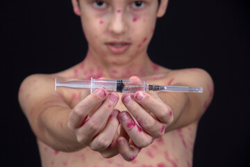 A boy is holding a syringe with a vaccine for the virus in his hand.