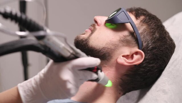Laser depilation of beard contour. Man getting permanent laser face hair removal at beauty salon.