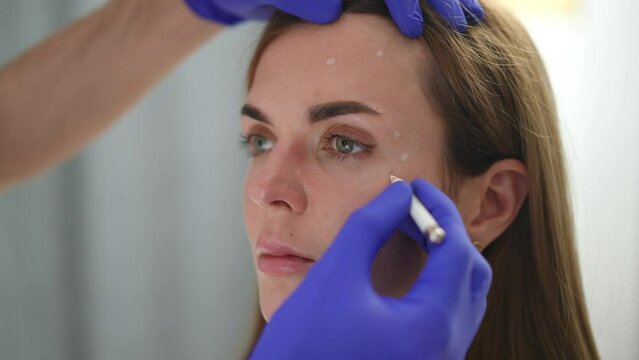 Close-up hand in gloves marking dots for beauty injections on female face. Unrecognizable Caucasian cosmetician preparing client for facelift filler injection. Femininity and beauty care concept
