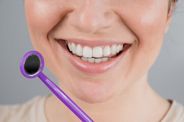 Caucasian woman with snow white smile holding dentist mirror.