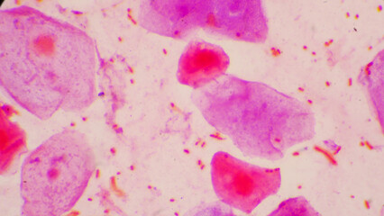 Bacteria cell Gram neagative bacilli with capsule pathogen.Sample sputum in Gram stain method.