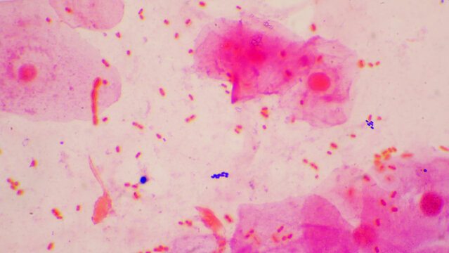 Bacteria cell Gram neagative bacilli with capsule pathogen.Sample sputum in Gram stain method.