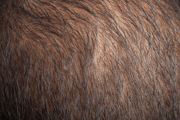 macro view of hair loss scalp head