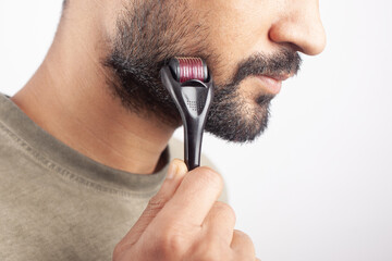 microneedling hair loss treatment on beard growth