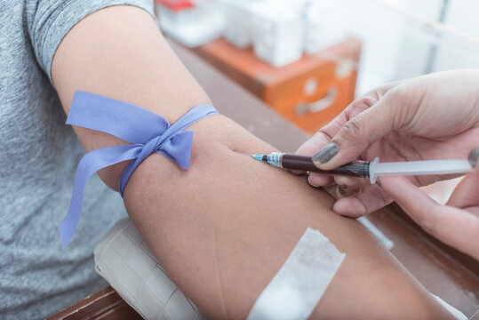 A nurse or phlebotomist draws blood from the vein of a patient. An IV Tourniquet placed above the elbow. Venipuncture for blood testing or hematology analysis.