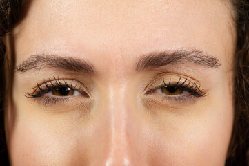 girl eyes with myopia while squinting to see better