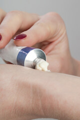 Close up image of hands with ointment tube. Skin care and health care concept.	