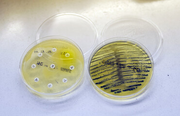 FRANCE - PARIS - BOITE DE PETRI