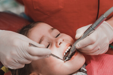 Dentist cleans tooth decay in a child with a drill, in the child's mouth ejector saliva.
