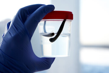Leeches in a jar in a hand in a blue glove in a laboratory