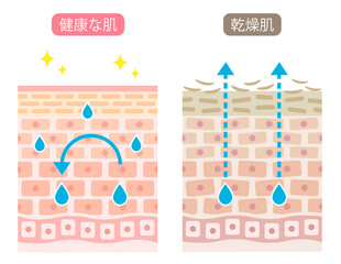 乾燥肌　断面　ビフォアアフター