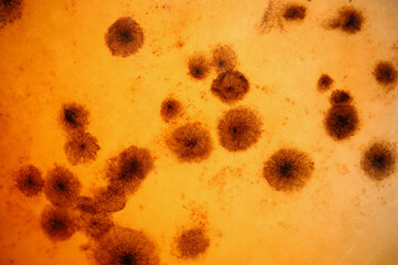 Blood analysis with microbes under microscope, material professional laboratory equipment