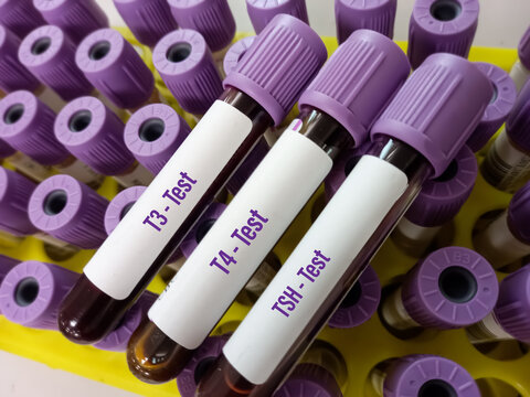 Blood sample for Thyroid panel hormone test for T3, T4, TSH with laboratory background.