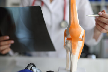 Doctor traumatologist demonstrating bones of knee joint on artificial model and taking xray picture...