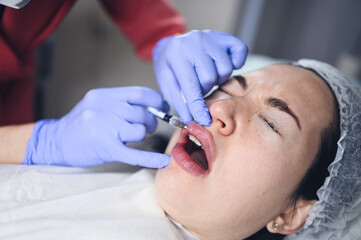 Cosmetologist doing painful lip augmentation procedure with hyaluronic acid. The beautician pierces...